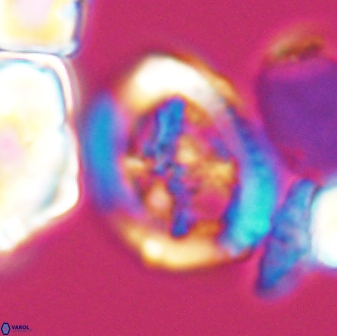 Grantarhabdus coronadventis 8679