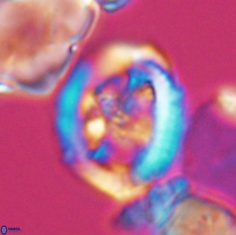 Grantarhabdus coronadventis 8681