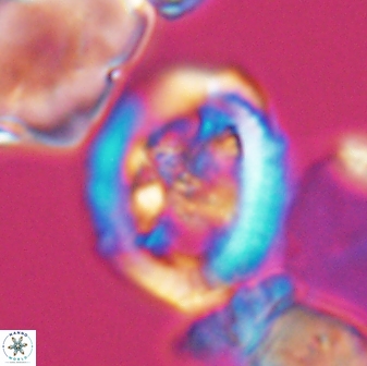 Grantarhabdus coronadventis 8681