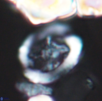 Grantarhabdus coronadventis 8683