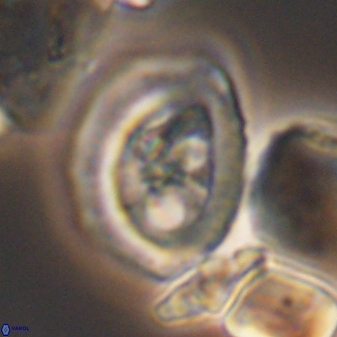 Grantarhabdus coronadventis 8685