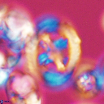 Grantarhabdus coronadventis 8776