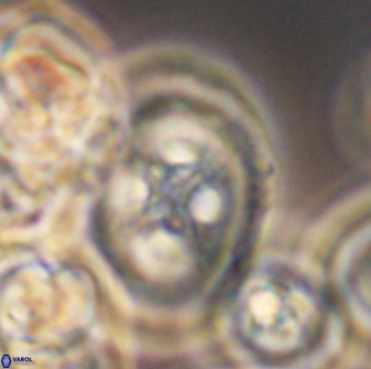 Grantarhabdus coronadventis 8783