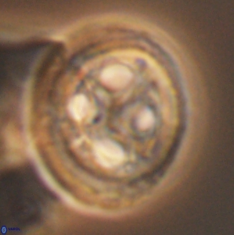 Grantarhabdus coronadventis 8998