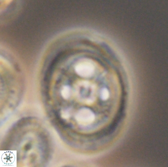 Grantarhabdus coronadventis 9222