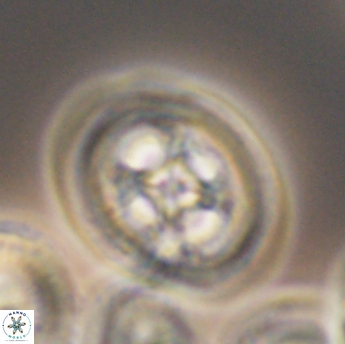 Grantarhabdus coronadventis 9223