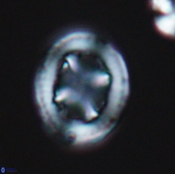 Grantarhabdus coronadventis 9304