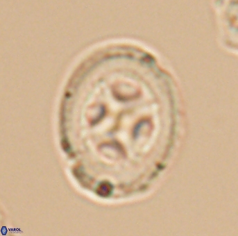 Grantarhabdus coronadventis 9306