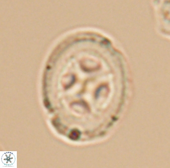 Grantarhabdus coronadventis 9306
