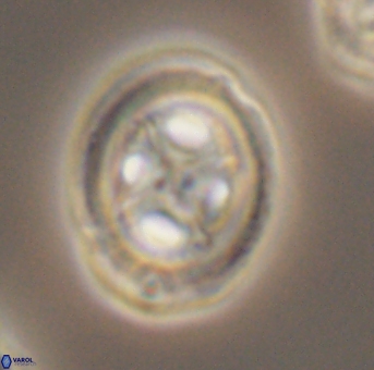 Grantarhabdus coronadventis 9307