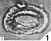 Helicosphaera ampliaperta 349