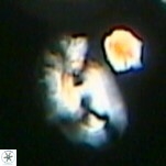 Helicosphaera bownii VR 09510