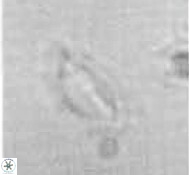 Helicosphaera californiana 27575