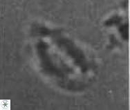 Helicosphaera californiana 27575