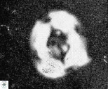 Helenea chiastia 42549