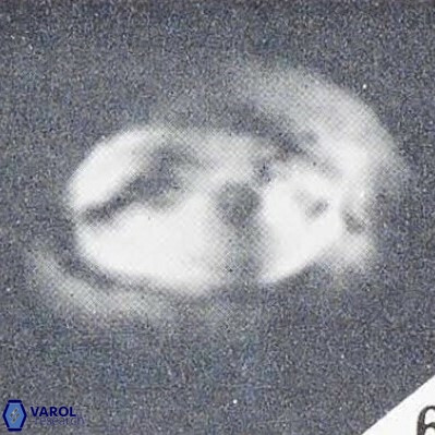 Helicosphaerella compacta VR 027539
