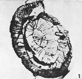 Helicosphaera euphratis 367