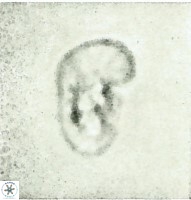 Helicosphaera intermedia 473