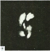 Helicosphaera intermedia 473