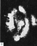 H papillata3