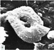 Helicosphaerella philippinensis VR 09840