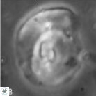 H prolixa2