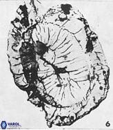 Helicosphaerella recta VR 028494