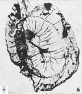 Helicosphaerella recta VR 028494
