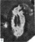 Helicosphaera scissura 339