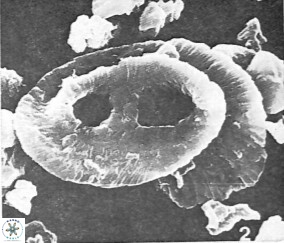 Helicosphaera truempyi 2378
