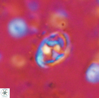 Hayesites irregularis 14473