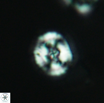 Helenea acuminata 2607
