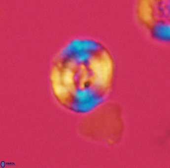 Helenea acuminata 2609