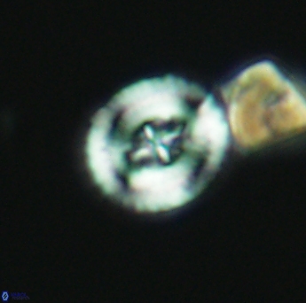 Helenea acuminata 2651