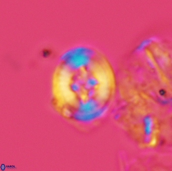 Helenea acuminata 3528