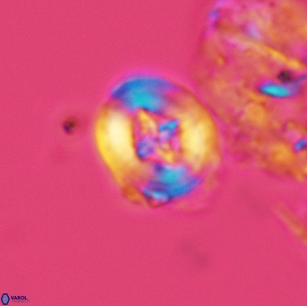 Helenea acuminata 3529