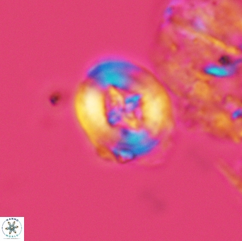 Helenea acuminata 3529