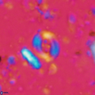 Helenea cf acuminata 1285