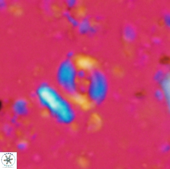 Helenea cf acuminata 1285