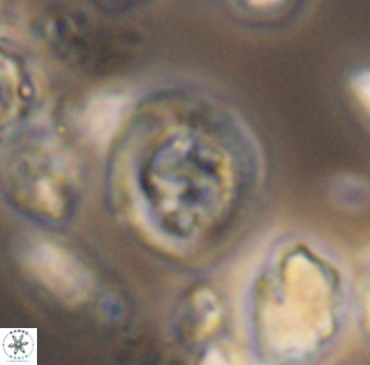 Helenea dikrorhethe 13334