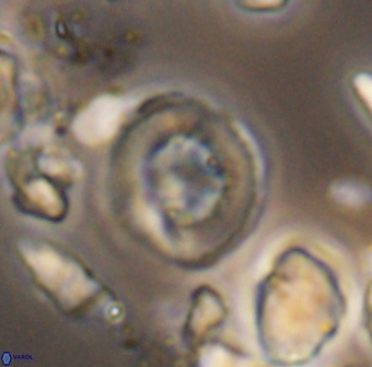 Helenea dikrorhethe 13335