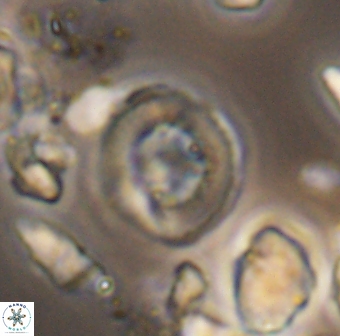 Helenea dikrorhethe 13335