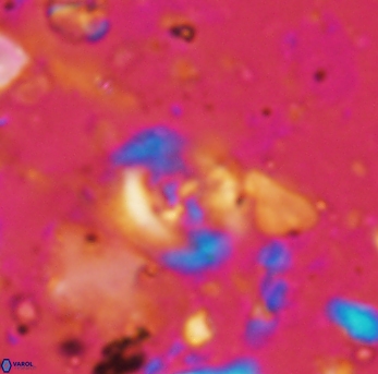 Helenea staurolithina 976