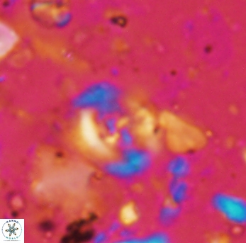 Helenea staurolithina 976