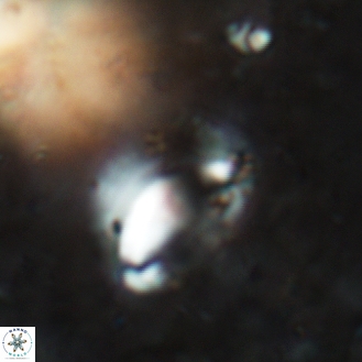 Helicosphaera magnifica 31