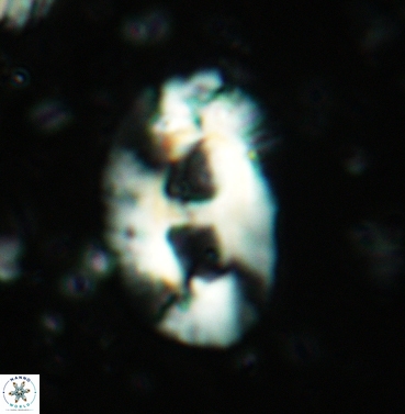 Helicosphaera mediterranea 6234