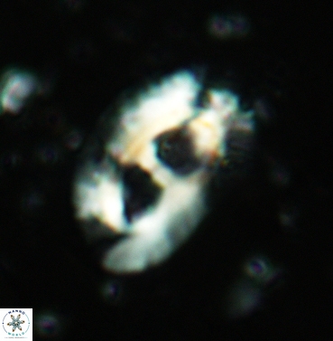 Helicosphaera mediterranea 6235