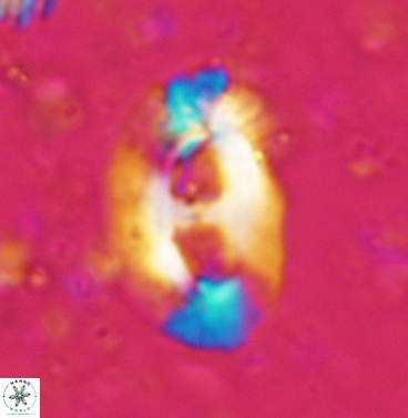 Helicosphaera mediterranea 6233