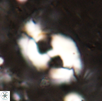 Helicosphaera mediterranea 27777
