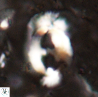 Helicosphaera mediterranea 27774